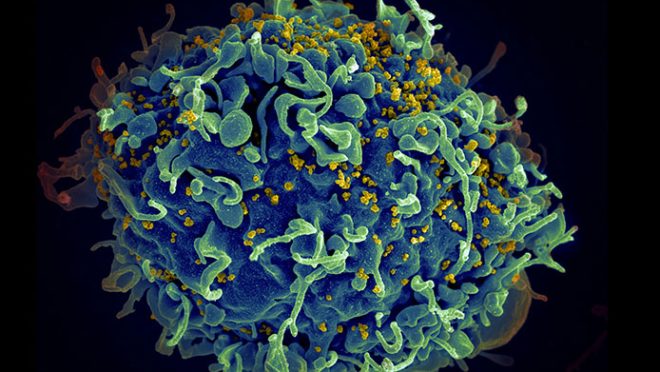 hiv