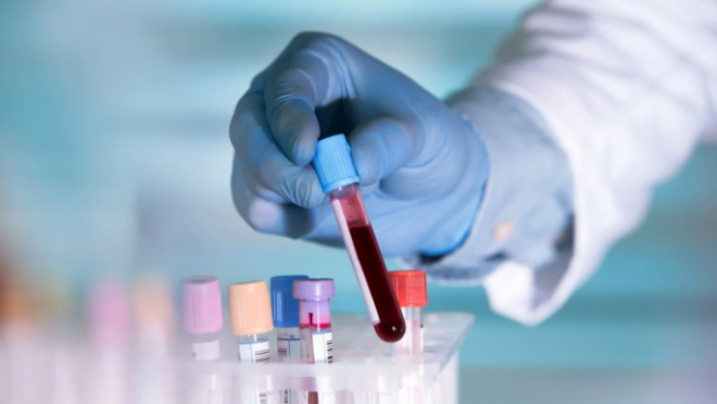 blood_type_a