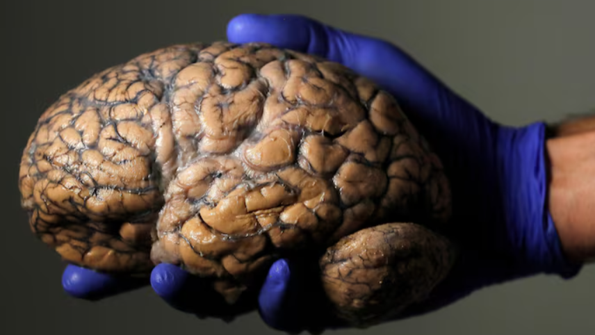 Brain
