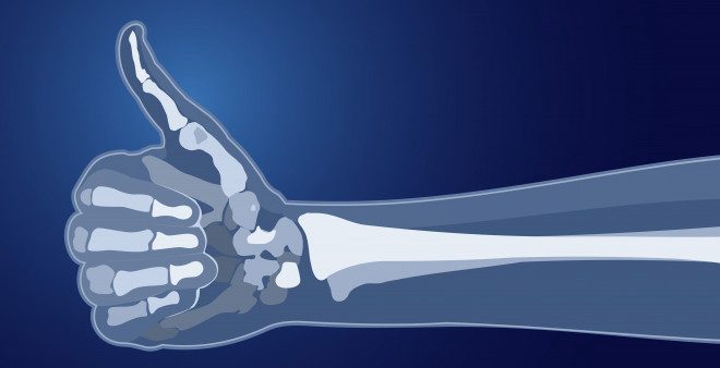 69255_bones-thumbs-up-istock-000083691675.jpg_fb7eb827-7048-4c16-af28-e833191ab1b3