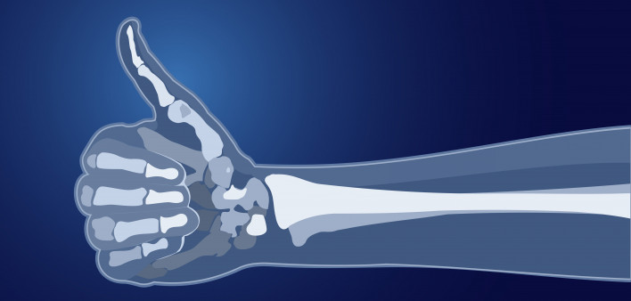 69255_bones-thumbs-up-istock-000083691675.jpg_fb7eb827-7048-4c16-af28-e833191ab1b3