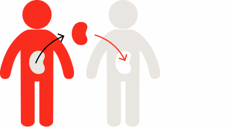 kidney-donation