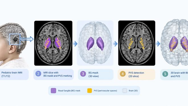 brain