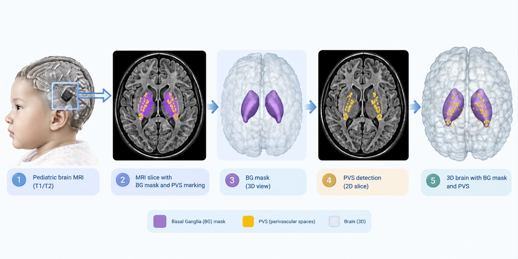 brain